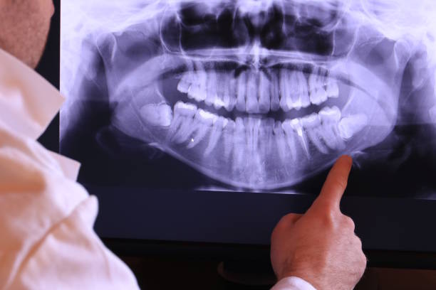 Best Emergency Treatment for Jaw Pain or Injury in Gilbert, IA